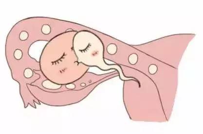 胚胎培养箱